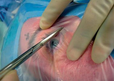 แว่นสายตา / จักษุ Disposable Sterile Drapes ผ่าตัดด้วยฟิล์มแผลที่มีกระเป๋าเก็บของเหลว