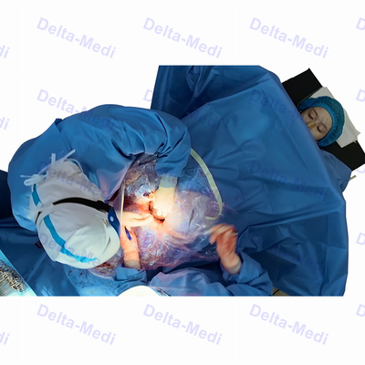 ผ้าม่านผ่าตัด C ปลอดเชื้อพร้อม Fenestration Obsterics Gynaecology Drape Pack